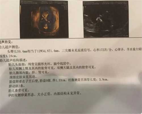供卵咨询中心,HIV艾滋病去首都医科大学附属北京妇产医院做试管婴儿要多少钱