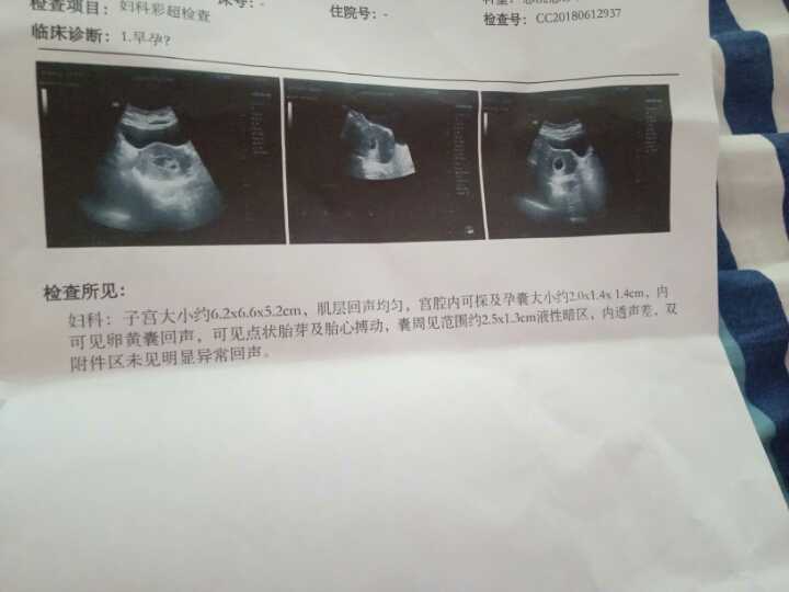 北京代生女孩,北京四院试管成功率 北京医院做试管婴儿需要花多少钱?！